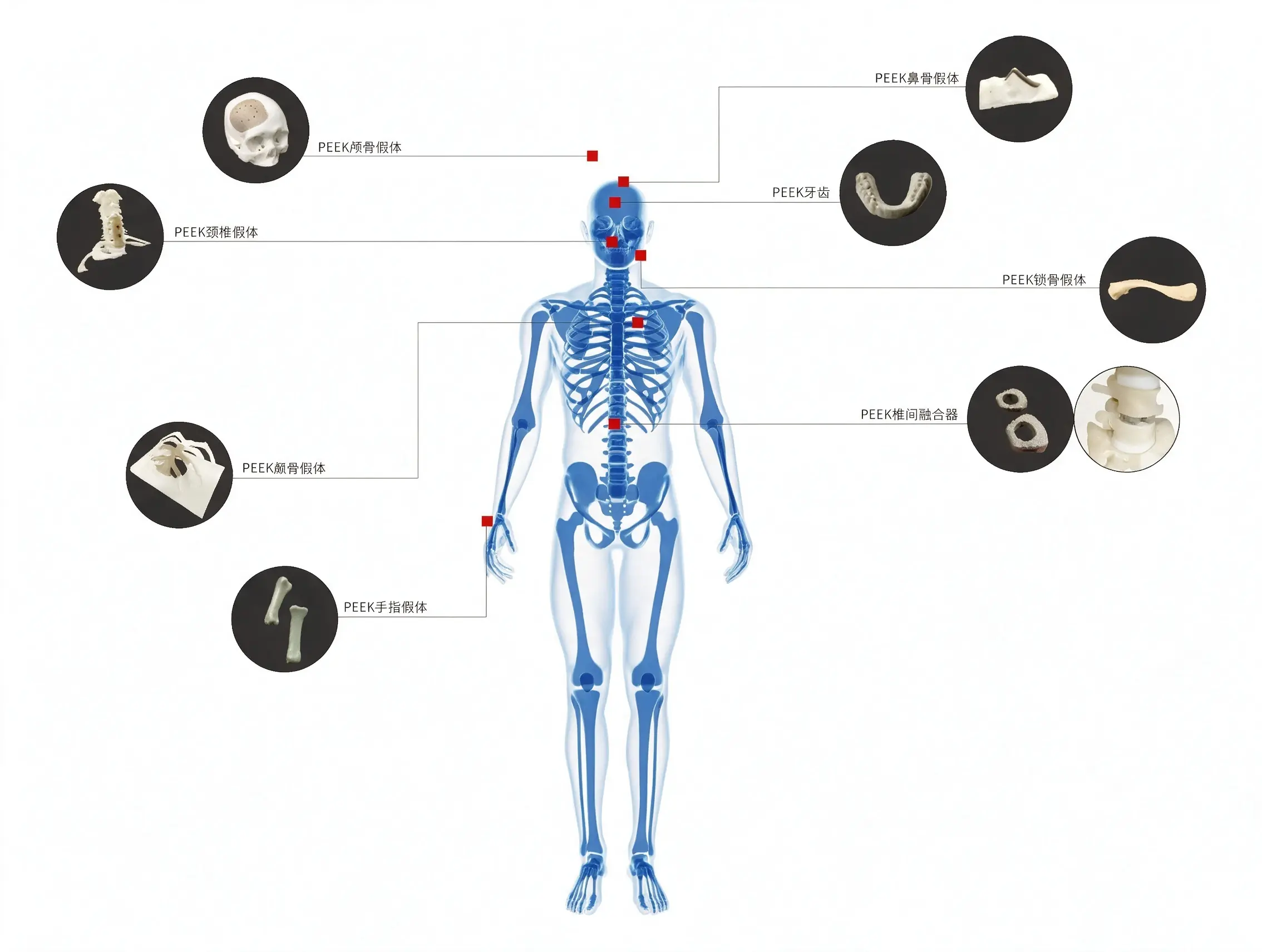 CNPEEK medical application